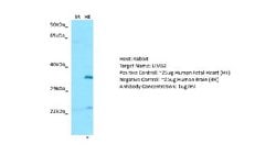 LIMS2 Rabbit anti-Human, Polyclonal, Novus Biologicals 0.1ml; Unconjugated:Antibodies,